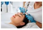 Can RF Microneedling in Luton Help Reduce Acne Scars?