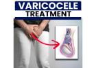 cure varicocele naturally