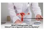 The Tiny Camera That Can Solve Your Uterus Problems