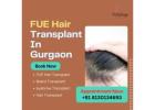 Call Now For | FUE Hair Transplant In Gurgaon