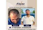 How to Evaluate Hair Transplant Specialist in Chandigarh