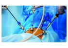 Best Laparoscopic Surgery Hospital in Kolkata