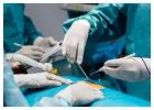 Expert Laparoscopic Surgeon In Delhi - Hok Hospital