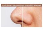 How to Remove Blackheads from Nose Naturally Quickly Permanently & Instantly