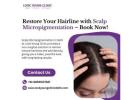 Restore Your Hairline with Scalp Micropigmentation – Book Now!