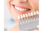 Invisalign in Santa Clara: The Clear Path to a Perfect Smile