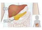 Advanced Liver and Pancreas Care in Ludhiana – Dr. Nitin Behl