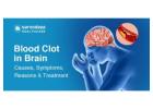 What is the Symptoms of Blood Clot in the Brain?