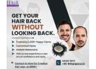 “Get Your Hair Back Without Looking Back at Hair Fixing Zone!